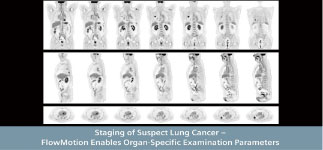 PET-CT 촬영사진