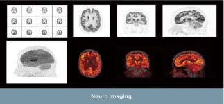 PET-CT 촬영사진