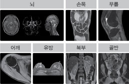 MRI 사진